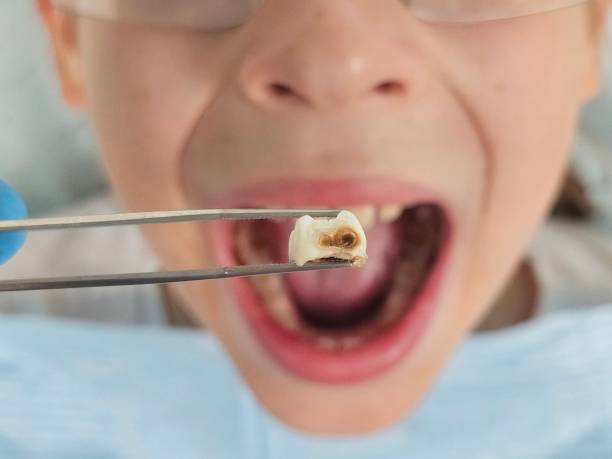 Best 24-Hour Emergency Dentist in Lanse, MI